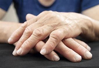 Living Better with Arthritis: How Arthritis Products Can Make a Difference